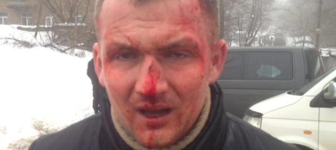 В Киеве избили народного депутата Левченко. Нардепа увезли в больницу