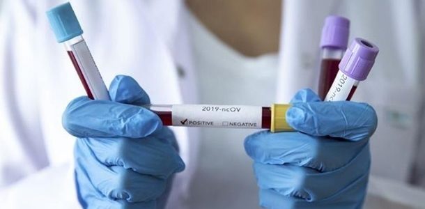 Родные второй жертвы коронавируса сделали громкое заявление против медиков